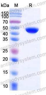 Recombinant Human FAH Protein, C-His