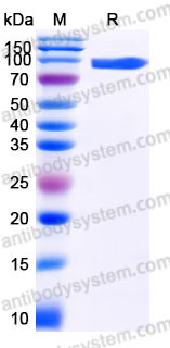 Recombinant Human NPR3 Protein, C-Fc