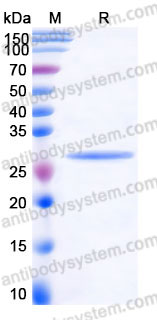 Recombinant Human CTRB1 Protein, C-His