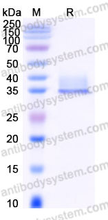 Recombinant Human LGALS3/Galectin-3 Protein, C-His
