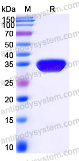 Recombinant Human EPOR Protein, C-His