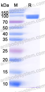 Recombinant Human CD106/VCAM1 Protein, C-His