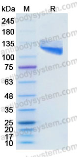 Recombinant Human CD106/VCAM1 Protein, C-Fc