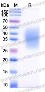 Recombinant Human ORM2 Protein, C-His