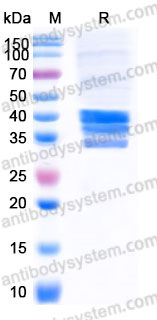 Recombinant Human FST/Follistatin Protein, C-His