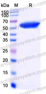 Recombinant Human AMY2B Protein, C-His