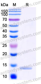 Recombinant Human IGKC/kappa light chain Protein, C-His