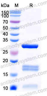 Recombinant Human KLK2 Protein, C-His