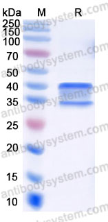 Recombinant Human CD120b/TNFRSF1B/TNFR2 Protein, C-His
