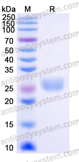 Recombinant Human EFNA1 Protein, C-His