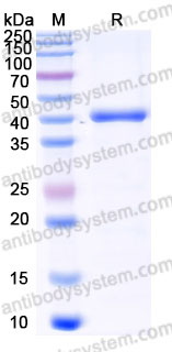 Recombinant Human COL9A1 Protein, C-His
