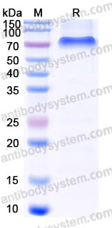 Recombinant Human CNR1/CB1 Protein, N-Flag & C-10*His