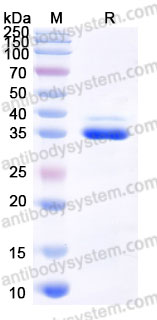 SDS-PAGE for Recombinant Human GPD1 Protein, C-His ?>