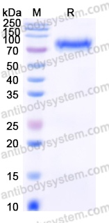 Recombinant Human EPHA1 Protein, C-His