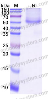 Recombinant Human BGN Protein, C-His