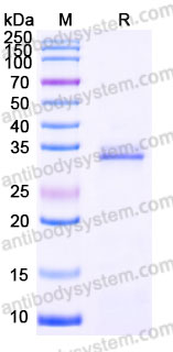 Recombinant Human IGFBP4 Protein, C-His
