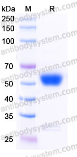 Recombinant Human MMP8 Protein, C-10*His