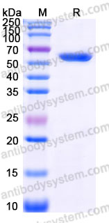 Recombinant Human CES1 Protein, C-His