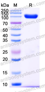 Recombinant Human CD238/KEL Protein, C-His