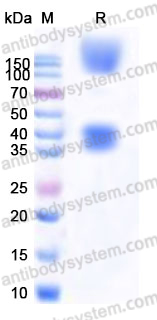Recombinant Human Laminin 211 E8 Protein, N-His  & N-Fc & N-Fc