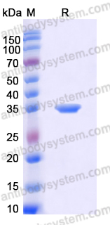 Recombinant Human PRTN3 Protein, C-His