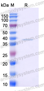 Recombinant Human CRHBP Protein, C-His