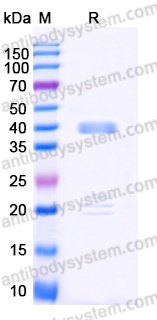 Recombinant Human IGFBP5 Protein, C-His