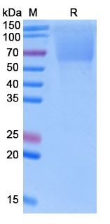 Recombinant Human GUCY2C/GCC Protein, C-His