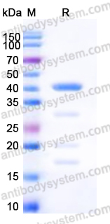 Recombinant Human AZGP1 Protein, C-His