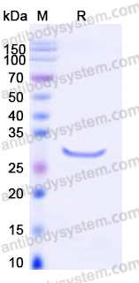 Recombinant Human HMGB2 Protein, C-His