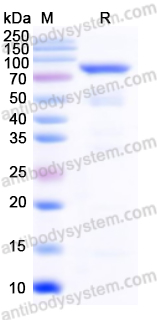 Recombinant Human TARS1 Protein, N-His