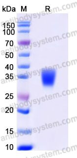 Recombinant Human CD159a/KLRC1 Protein, N-8*His
