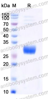 Recombinant Human KLRC1 & CD94 Heterodimer, N-8*His & N-Flag