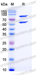 Recombinant Human COL8A1 Protein, C-His