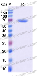 Recombinant Human CANX Protein, C-His