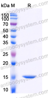 Recombinant Human CST5 Protein, C-His