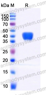 Recombinant Human CD38/ADPRC 1 Protein, N-His (Active)