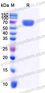 Recombinant Human IL12A/IL-12 p35/NKSF1 Protein, C-Fc