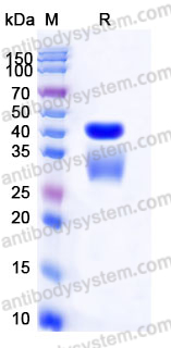 Recombinant Human IL12 Heterodimer, Tag free