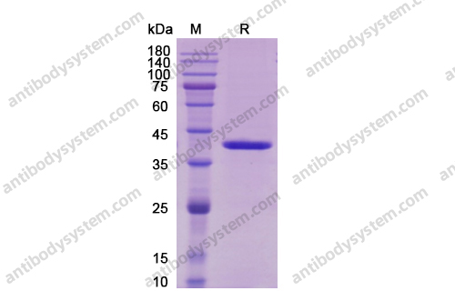 Recombinant Human IL12B/IL-12 p40/NKSF2 Protein, C-Flag