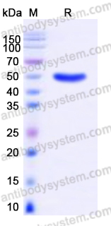 Recombinant Human SERPINB3 Protein, C-His