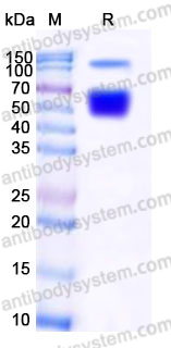 Recombinant Human SERPINA4 Protein, C-His