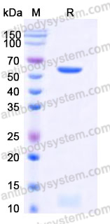 Recombinant Human PDIA3 Protein, C-His