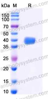 Recombinant Human CHRNA5 Protein, C-His