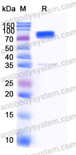 Recombinant Human CD132/IL2RG Protein, C-Fc