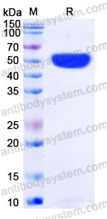 Recombinant Human SHMT1 Protein, C-His