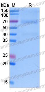 Recombinant Human GPC1 Protein, C-His