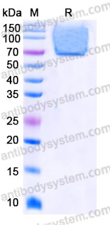 Recombinant Human GPC1 (R309P) Protein, N-His