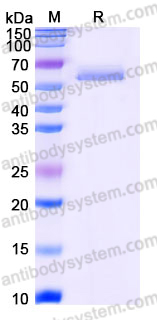 Recombinant Human SERPINF1/PEDF/Serpin F1 Protein, C-His