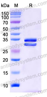 Recombinant Human CFHR2 Protein, C-His